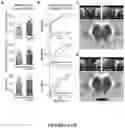 Fig. 03 - USE OF NEUROMELANIN-SENSITIVE MRI AS A BIOMARKER OF DOPAMINE FUNCTION