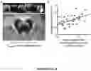 Fig. 07 - USE OF NEUROMELANIN-SENSITIVE MRI AS A BIOMARKER OF DOPAMINE FUNCTION