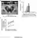 Fig. 09 - USE OF NEUROMELANIN-SENSITIVE MRI AS A BIOMARKER OF DOPAMINE FUNCTION