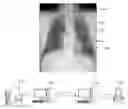 Fig. 01 - Method and system for determining abnormality in medical device