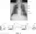 Fig. 02 - Method and system for determining abnormality in medical device