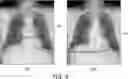 Fig. 09 - Method and system for determining abnormality in medical device