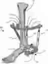 Fig. 01 - External fixation for the correction of bone deformity and trauma