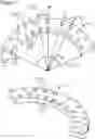 Fig. 02 - External fixation for the correction of bone deformity and trauma
