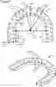 Fig. 03 - External fixation for the correction of bone deformity and trauma
