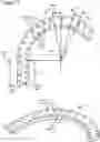 Fig. 04 - External fixation for the correction of bone deformity and trauma