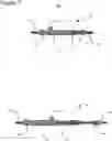 Fig. 08 - External fixation for the correction of bone deformity and trauma