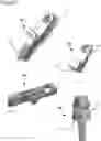 Fig. 09 - External fixation for the correction of bone deformity and trauma