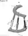 Fig. 13 - External fixation for the correction of bone deformity and trauma