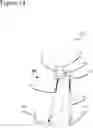 Fig. 15 - External fixation for the correction of bone deformity and trauma