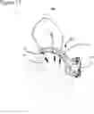 Fig. 18 - External fixation for the correction of bone deformity and trauma