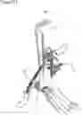 Fig. 22 - External fixation for the correction of bone deformity and trauma