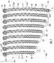 Fig. 02 - Periprosthetic Bone Plate