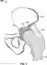Fig. 02 - Method and system for determining a relative position of a tool