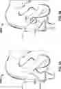 Fig. 07 - Method and system for determining a relative position of a tool