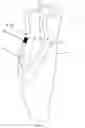 Fig. 02 - COSMESIS, SYSTEM CONSISTING OF PROSTHETIC COMPONENT AND COSMESIS, AND CONNECTION PART