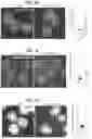 Fig. 26 - METHODS FOR TREATING CANCER BY INHIBITING CARM1