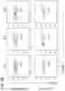 Fig. 52 - METHODS FOR TREATING CANCER BY INHIBITING CARM1