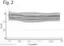 Fig. 03 - FECAL MATTER FOR TREATMENT OF CACHEXIA