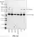 Fig. 02 - Pneumococcal conjugate vaccine formulations