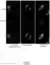 Fig. 02 - Formulation comprising a phosphocalcic cement and a physical and/or covalent hydrogel of polysaccharides, printable and having ductile mechanical properties for bone regeneration/bone repair