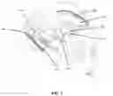 Fig. 02 - VISUAL PROSTHESIS EMPLOYING VENTRICULAR OR ENDOVASCULAR NEURAL ELECTRODE ARRAYS