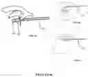 Fig. 07 - VISUAL PROSTHESIS EMPLOYING VENTRICULAR OR ENDOVASCULAR NEURAL ELECTRODE ARRAYS