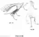 Fig. 09 - VISUAL PROSTHESIS EMPLOYING VENTRICULAR OR ENDOVASCULAR NEURAL ELECTRODE ARRAYS