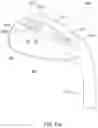 Fig. 12 - Golf club head