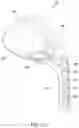 Fig. 23 - Golf club head