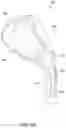 Fig. 24 - Golf club head