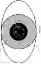 Fig. 05 - Methods and apparatus for detecting a presence and severity of a cataract in ambient lighting