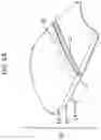 Fig. 02 - DEVICES AND METHODS FOR COSMETIC SKIN RESURFACING