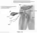 Fig. 09 - BONE FIXATION SYSTEM AND ELEMENTS THEREOF