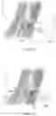 Fig. 35 - BONE FIXATION SYSTEM AND ELEMENTS THEREOF