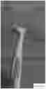 Fig. 07 - DOUBLE-ENDED ORAL CARE DEVICE WITH INTERCHANGEABLE SNAP-ON FLOSSERS AND DISPOSABLE IMPLEMENTS