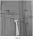 Fig. 08 - DOUBLE-ENDED ORAL CARE DEVICE WITH INTERCHANGEABLE SNAP-ON FLOSSERS AND DISPOSABLE IMPLEMENTS