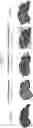 Fig. 12 - COMPOSITIONS USEFUL IN TREATMENT OF KRABBE DISEASE