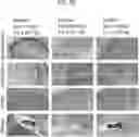 Fig. 22 - COMPOSITIONS USEFUL IN TREATMENT OF KRABBE DISEASE