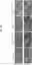 Fig. 32 - COMPOSITIONS USEFUL IN TREATMENT OF KRABBE DISEASE