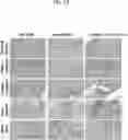 Fig. 47 - COMPOSITIONS USEFUL IN TREATMENT OF KRABBE DISEASE