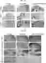 Fig. 48 - COMPOSITIONS USEFUL IN TREATMENT OF KRABBE DISEASE