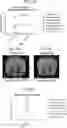 Fig. 72 - COMPOSITIONS USEFUL IN TREATMENT OF KRABBE DISEASE