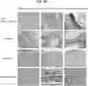 Fig. 74 - COMPOSITIONS USEFUL IN TREATMENT OF KRABBE DISEASE
