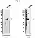 Fig. 02 - COMPOSITION FOR TREATMENT OF GLUTARIC ACIDURIA AND ADMINISTRATION METHOD THEREFOR