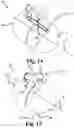 Fig. 09 - DRUG DELIVERY DEVICE