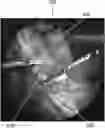 Fig. 01 - Method of alerting a user to off-screen events during surgery