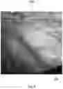 Fig. 06 - Method of alerting a user to off-screen events during surgery