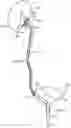 Fig. 01 - RENAL NERVE DENERVATION VIA THE RENAL PELVIS