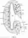 Fig. 04 - RENAL NERVE DENERVATION VIA THE RENAL PELVIS